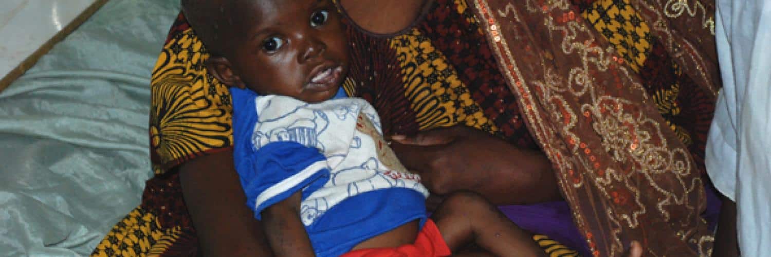 Malnutrition au Mali : enjeux et solutions pour sauver la santé des enfants